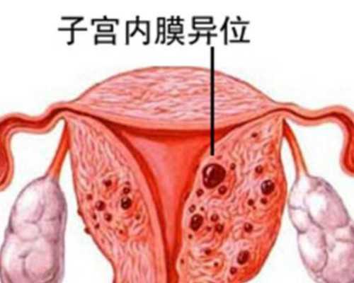 郑州人工受精医院哪家上海中山医院有供卵试管吗好_靠谱代孕案例