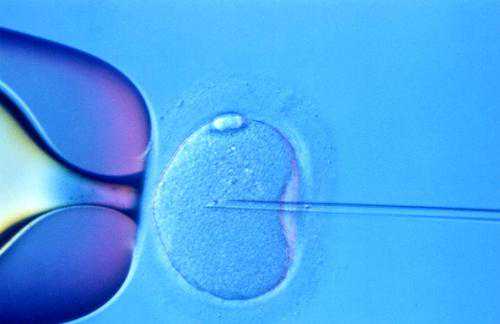 试管y染色体异常_双角子宫怀孕_「婴儿」试管婴儿的总费用哺乳期用药一览表