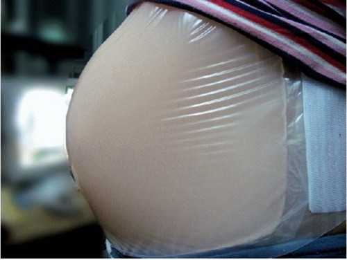 杭州供卵代生子_试管婴儿胚胎移植上写有80%照片